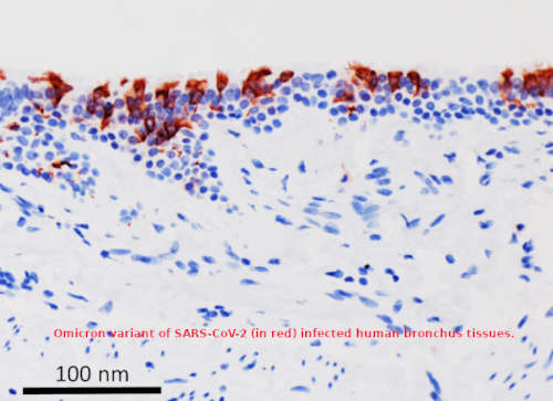 /media/0zaiypaj/omicron-variant-of-sars-cov-2-infected-human-bronchus-tissues.jpg