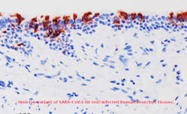 La Omicron trasforma Covid-19 da polmonite a bronchite