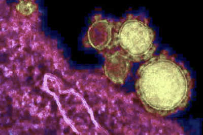 /media/1ejkadqj/coronavirus-variante-inglese-astrazeneca.jpg