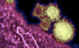 Covid 19, Draghi ordina di vaccinarsi con AstraZeneca. Perché?