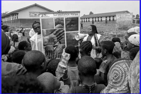 Quello che NON ci Dicono su MPOX Nuova Emergenza Sanitaria Mondiale