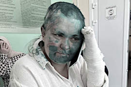 Caso Milashina, in Russia l'Elite si Indigna e Invoca la Legge