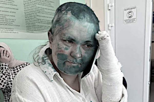 Caso Milashina, in Russia l'Elite si Indigna e Invoca la Legge